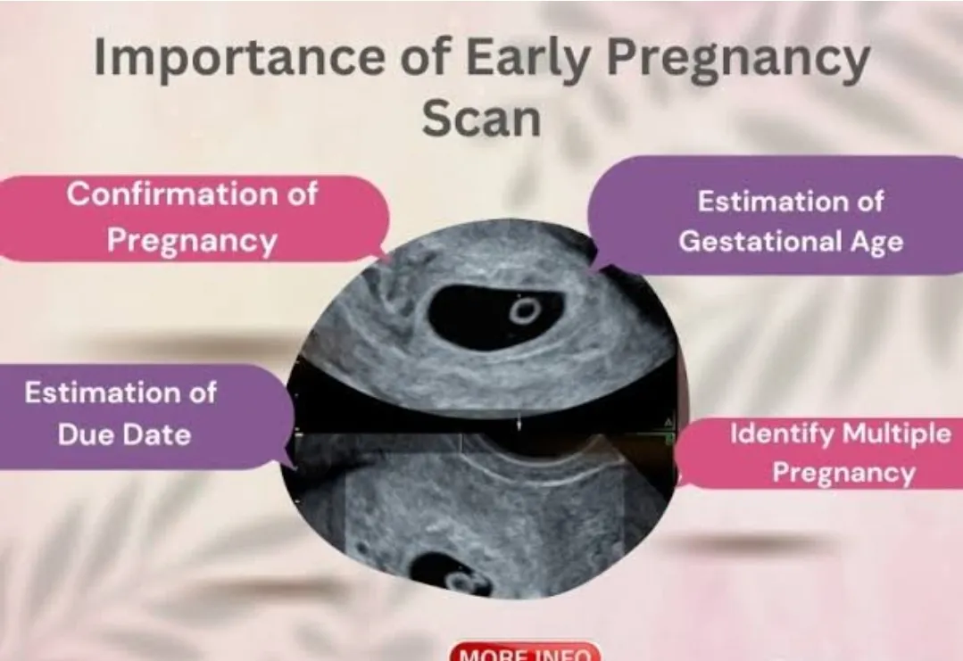 #An early pregnancy scan (usually performed betwee...