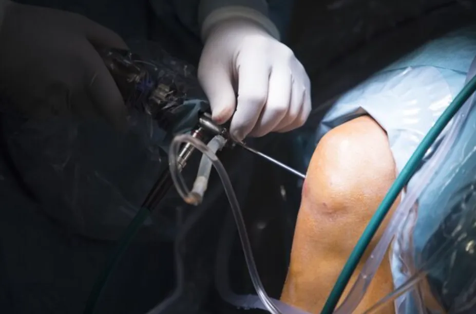 Robotic Knee Replacement in Bangalore – Precision ...