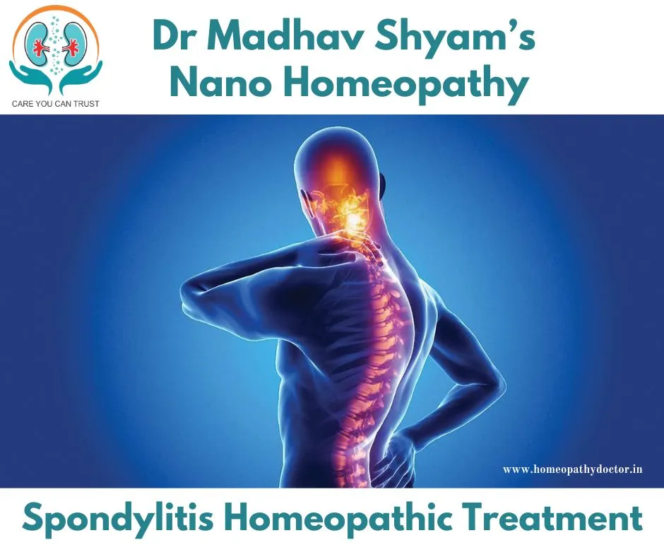 Spondylitis is a type of inflammatory arthritis th...