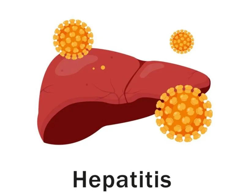 Viral Hepatitis and Its Management: Hepatobiliary ...