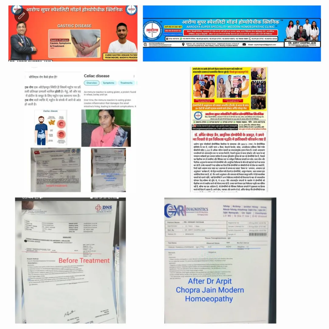 Coeliac disease, Gluten Allergy गेहूं से एलर्जी,Ga...
