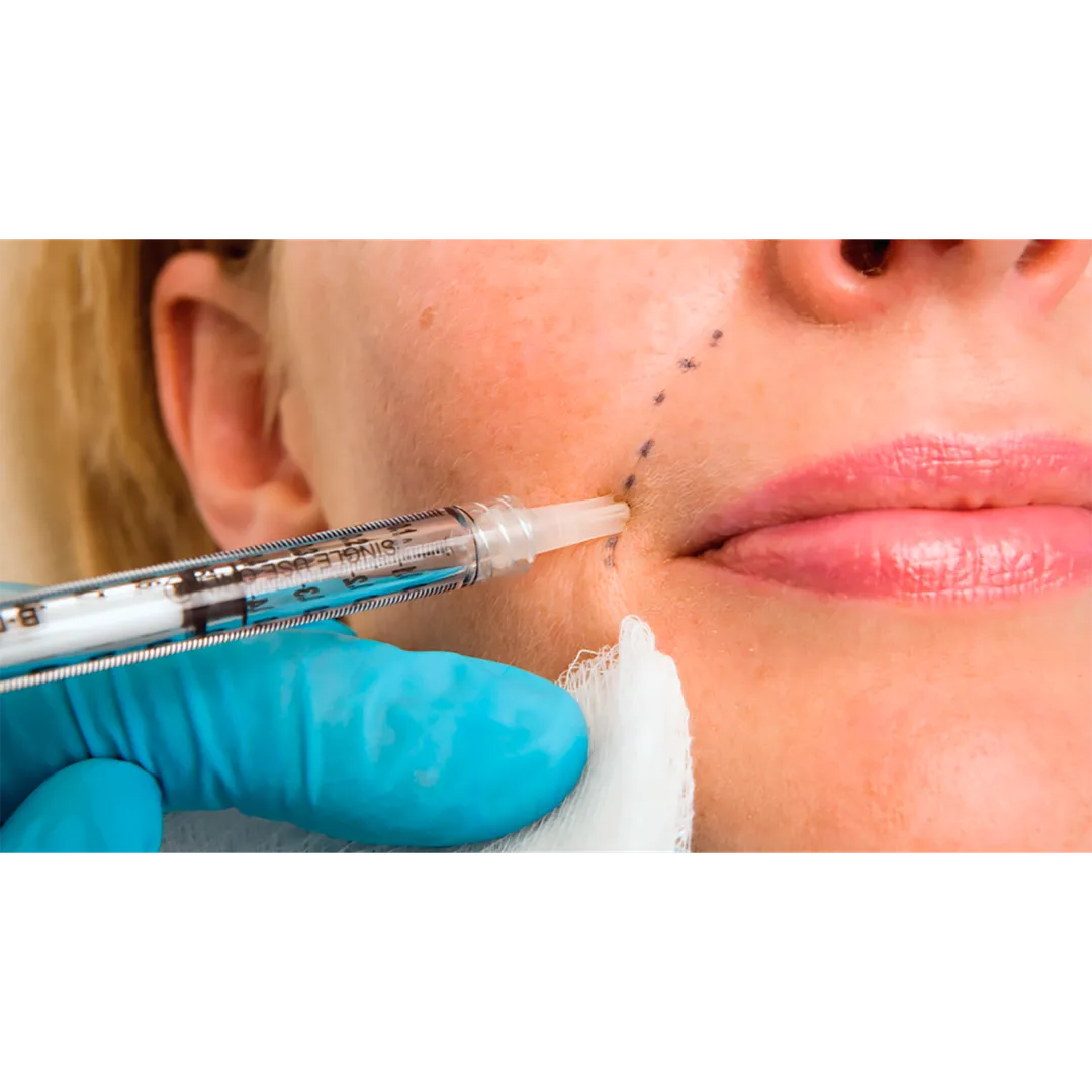Dermal Fillers in Dwarka
Dermal fillers are injec...