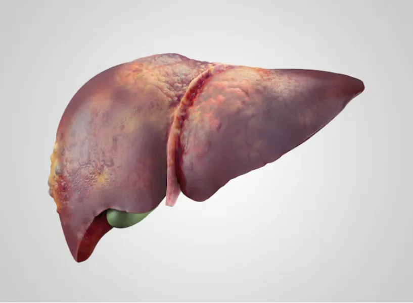 Liver Donor Guidelines in Mumbai – Essential Infor...