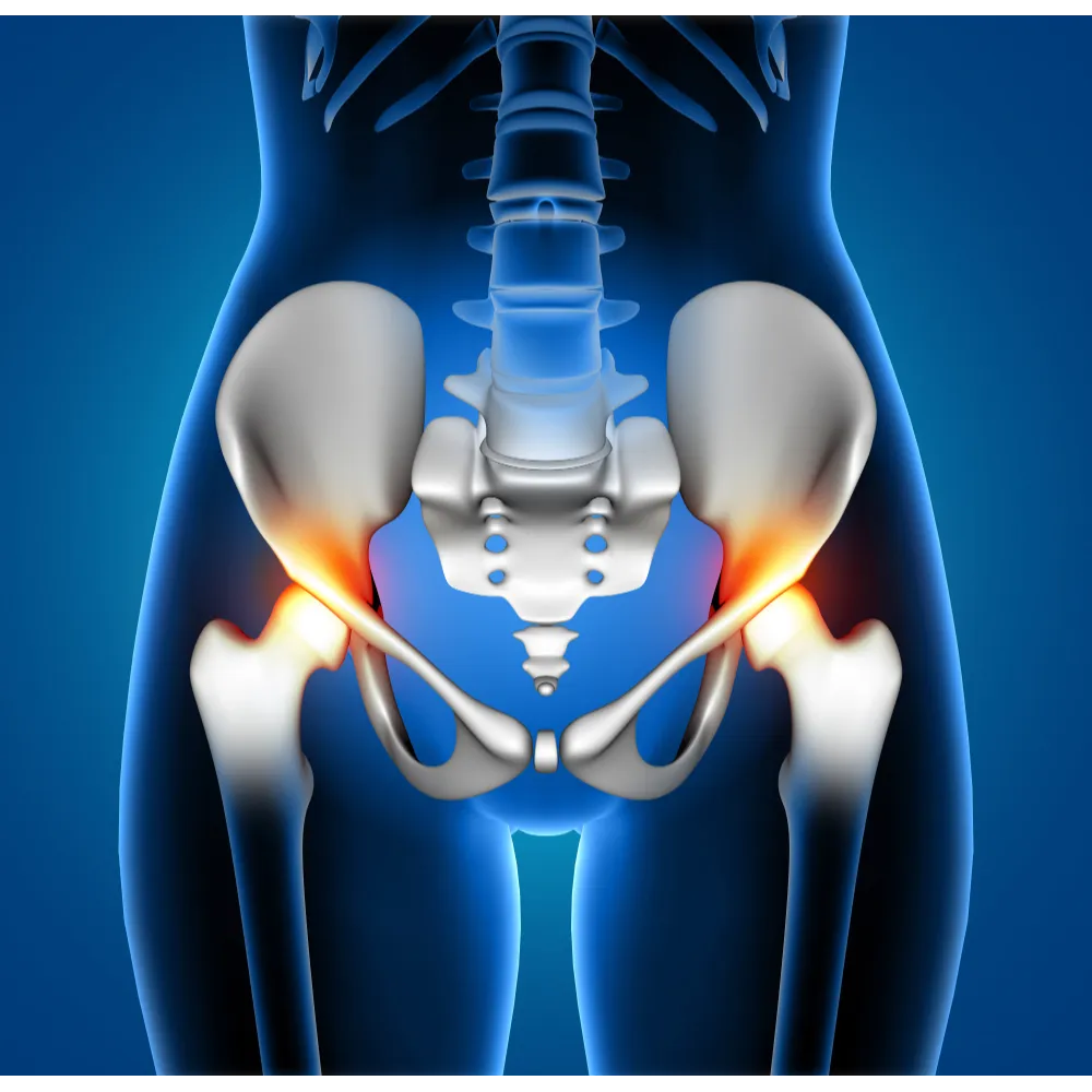 Hip Replacement Surgery in Noida for Improved Mobi...