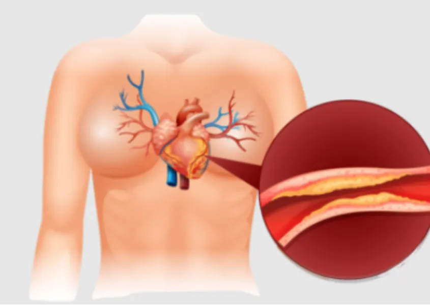 Best Heart Attack Prevention Specialist Near Me Pr...