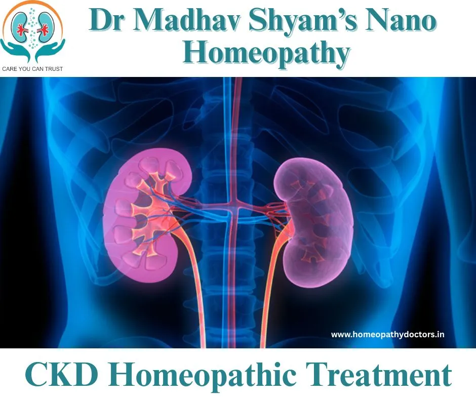 CKD stands for Chronic Kidney Disease. It’s a long...