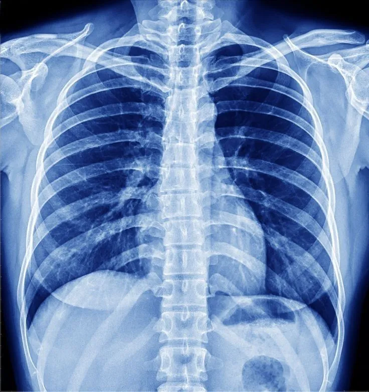 Radicare Digital Portable X-Ray Service – Trusted ...