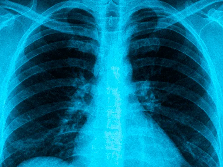 Portable X-Ray Services in Kondhwa, Pune – Radicar...