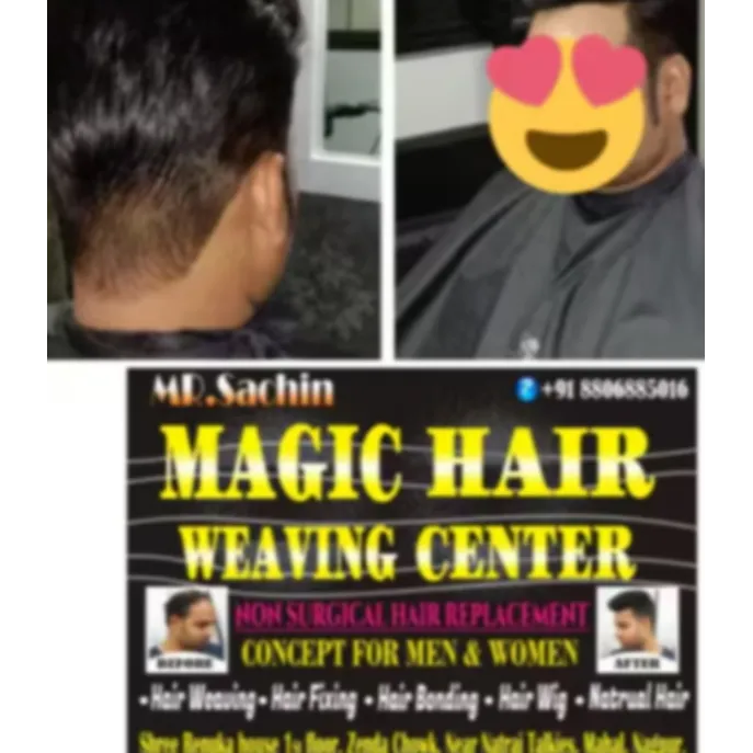 Best Hair Fixing Center in Nagpur – Non-Surgical H...