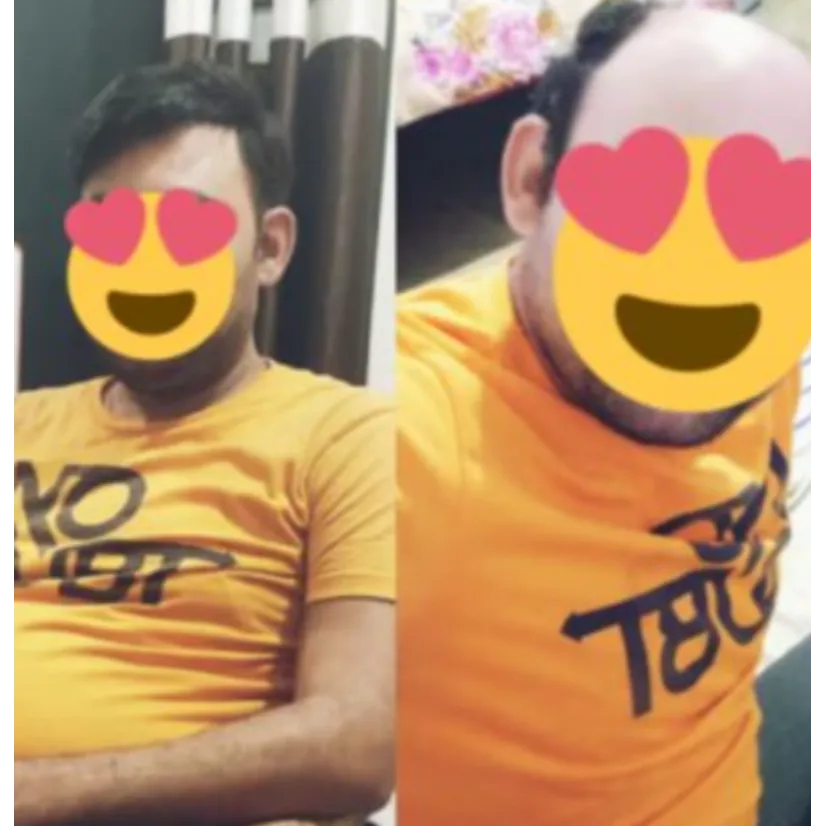 Best Hair Patch Center in Nagpur – Perfect Match f...