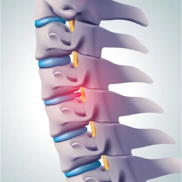 Spine Problem and Slipped Disc Treatment in Pimpri...