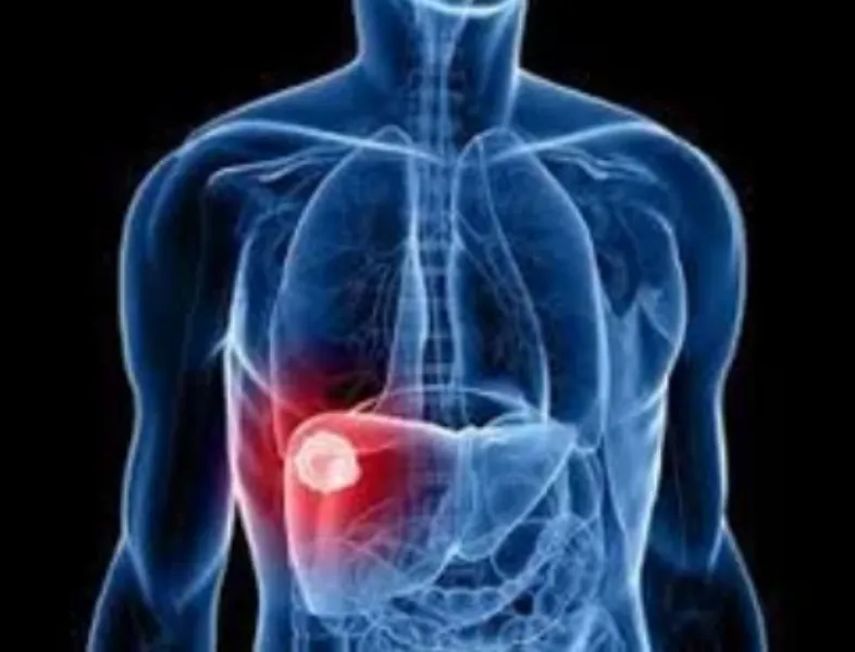 NAFLD Treatment in Mumbai – Effective Solutions fo...