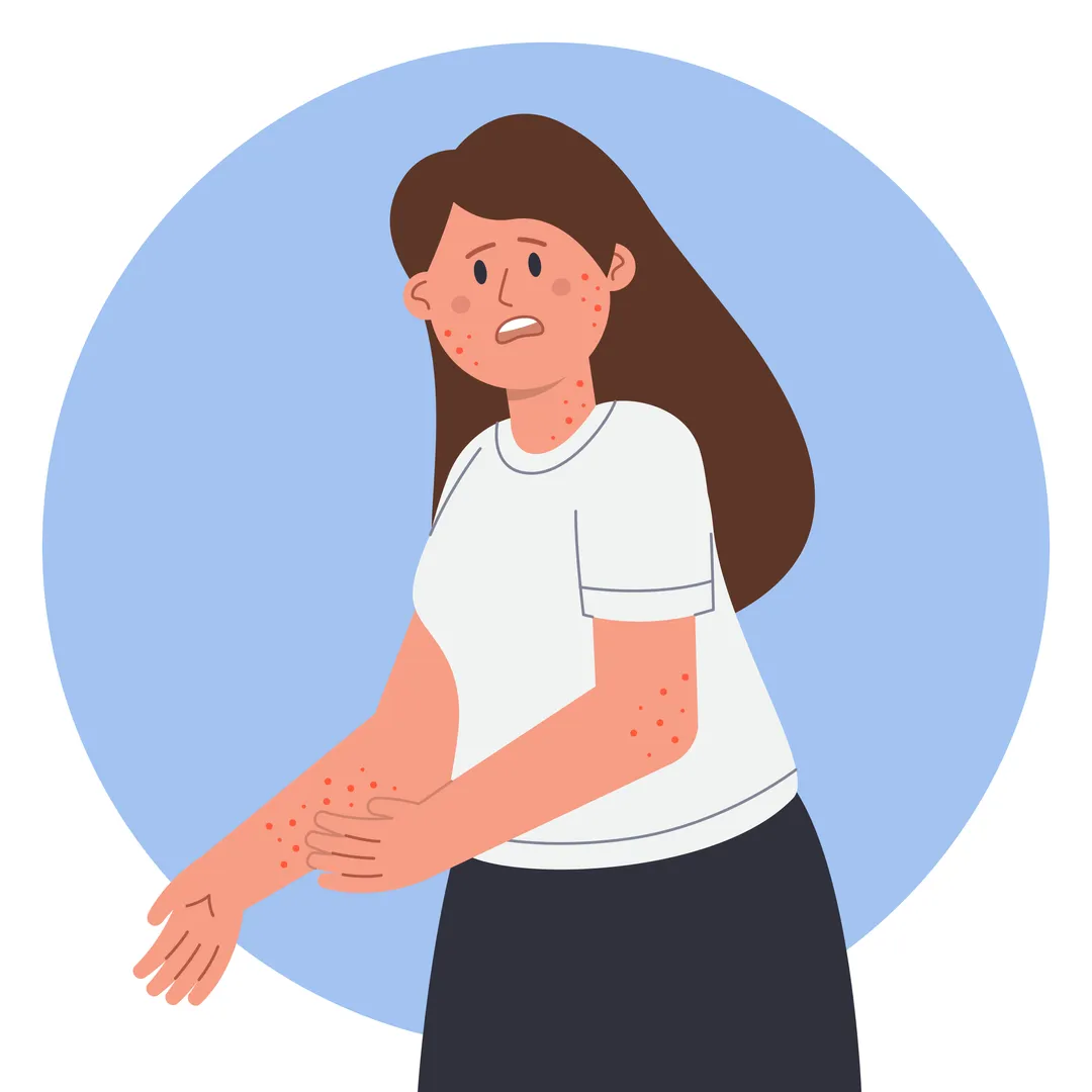 Discover effective treatments for pruritus in chol...
