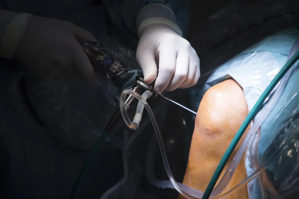 Arthroscopic Knee Surgery Expert in Delhi – Minima...