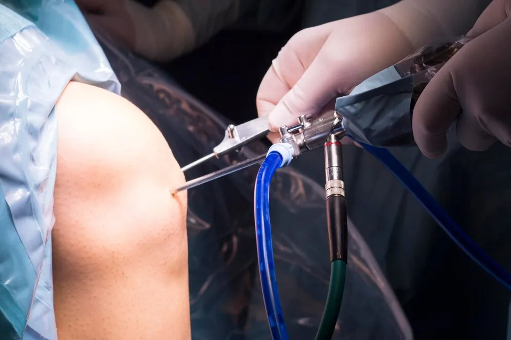 Rotator Cuff Surgery in New Tippasandra, Bengaluru...