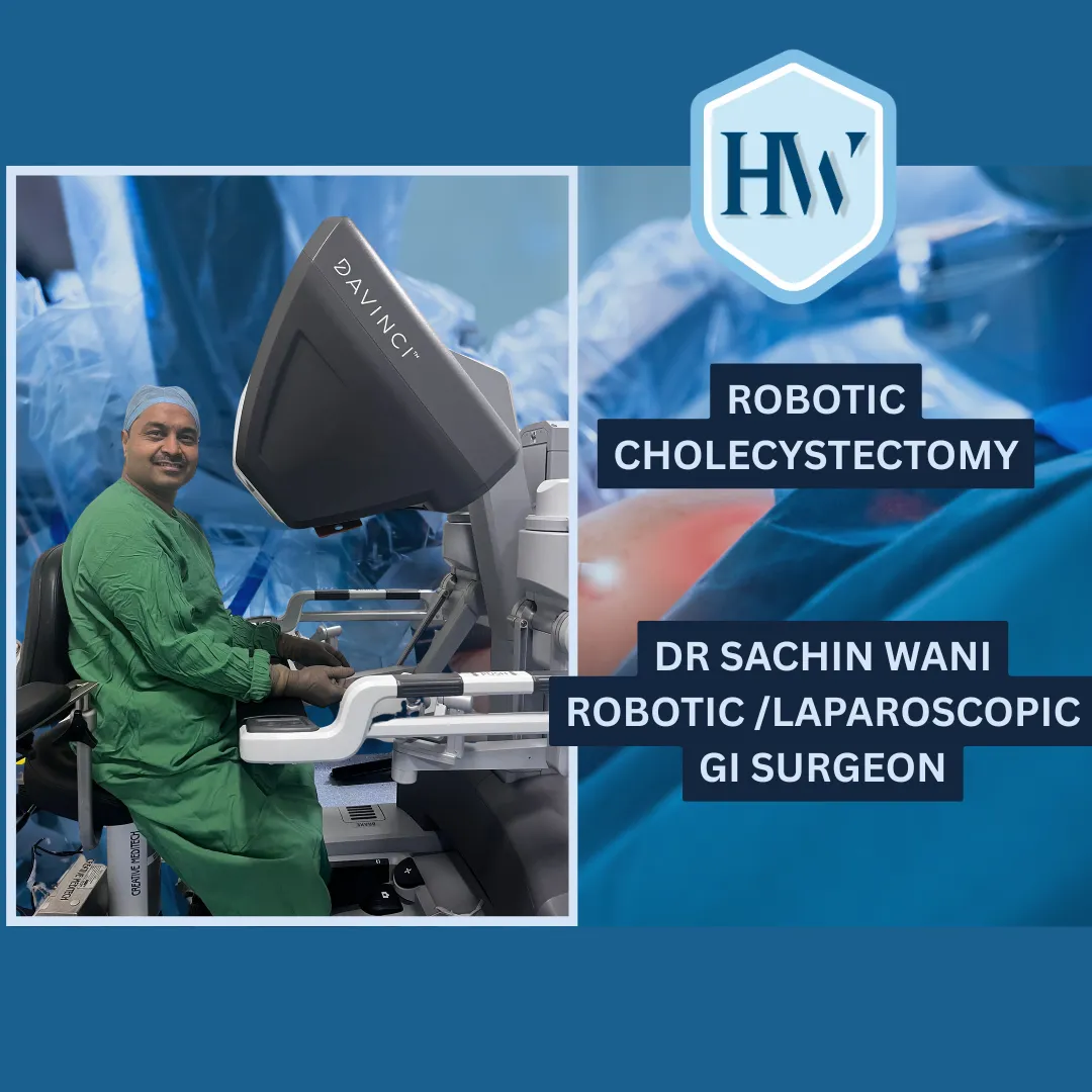 Robotic Cholecystectomy Surgery: Best Robotic GI S...