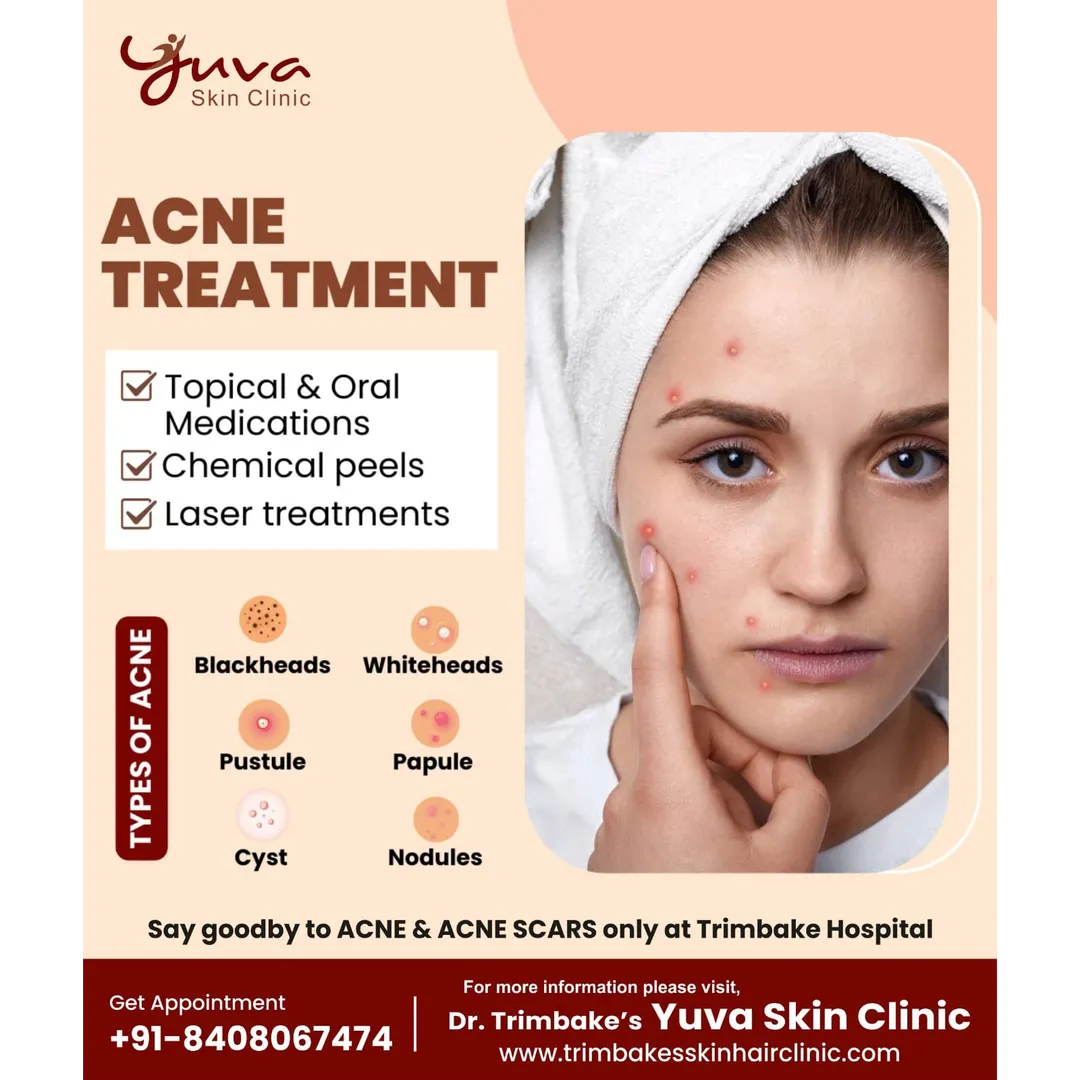 Say Goodbye to Acne! 🌟
Struggling with acne? Get c...