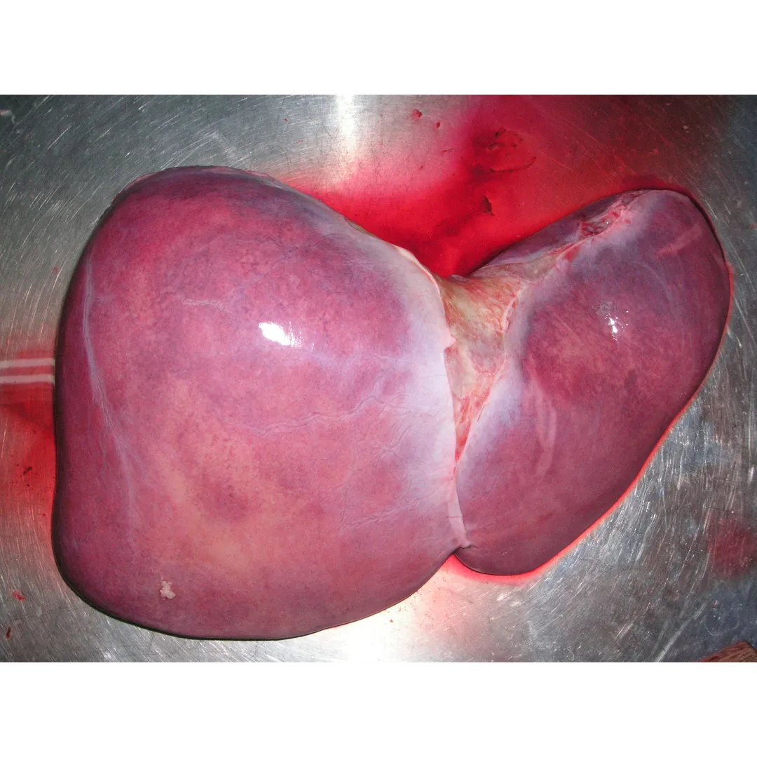 Global Virtual Liver Clinics (GVLC)
Second Opinio...