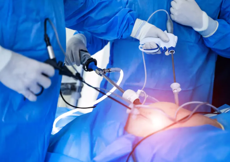 Best Laparoscopic Surgeries in Nagpur: Minimally I...