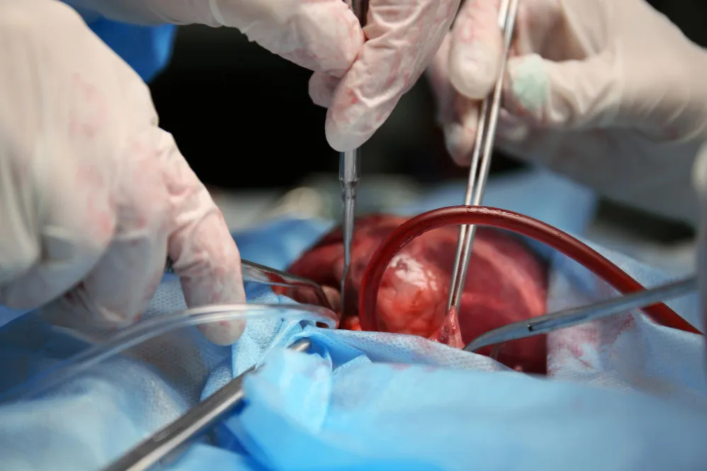 Small Incision Cardiac Surgery in Nagpur Small Inc...