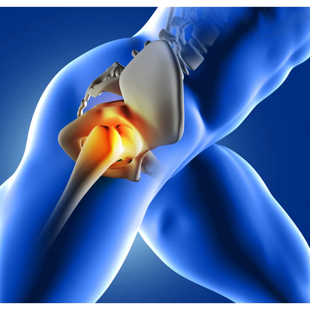 Relieving Sciatica Pain with Trusted Orthopaedic S...