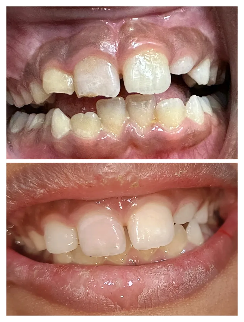 Take Care of Your Teeth While Playing! A young mal...