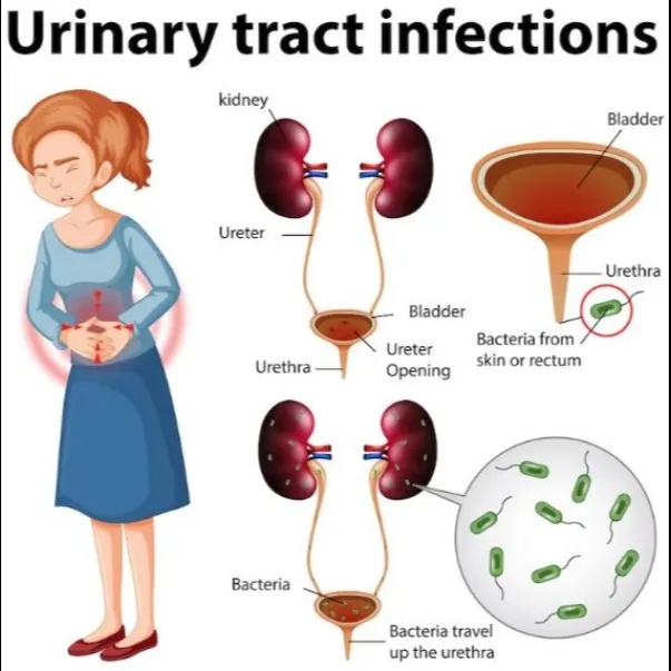Urinary Infection Treatment in Thane West – Fast D...