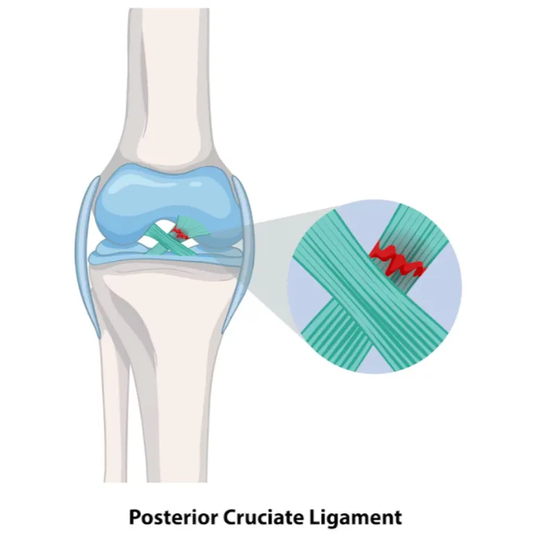Unicompartmental Knee Replacement in New Tippasand...