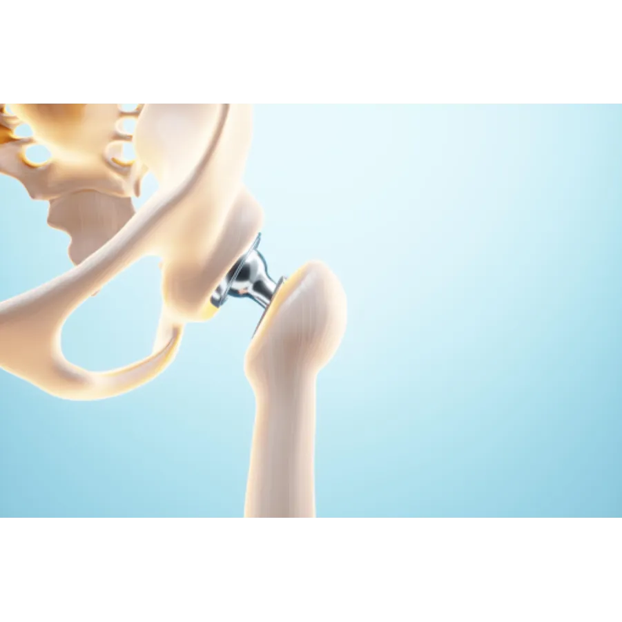 Top Hip Replacement Surgeon in Pimpri-Chinchwad fo...
