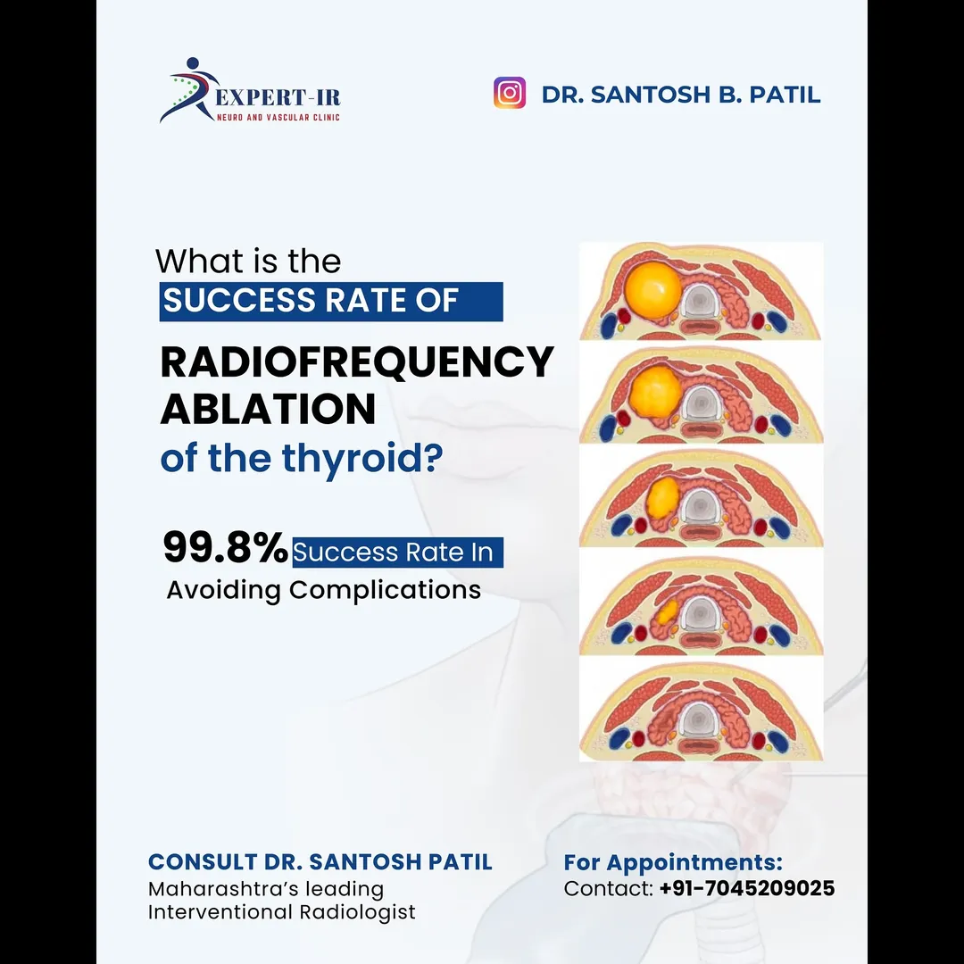Are you dealing with a thyroid nodule? 🤔
There’s n...