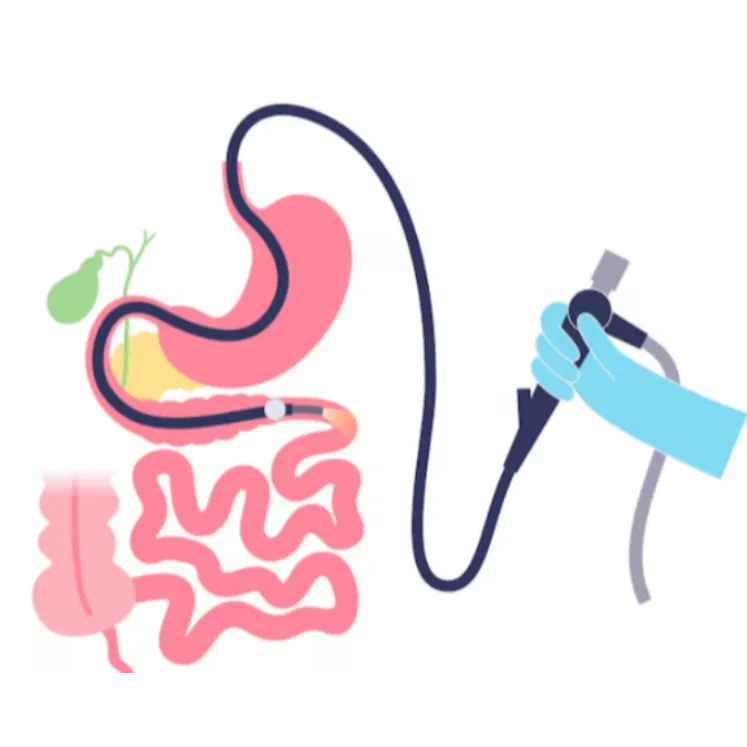 Double Balloon Enteroscopy – Advanced Diagnosis in...