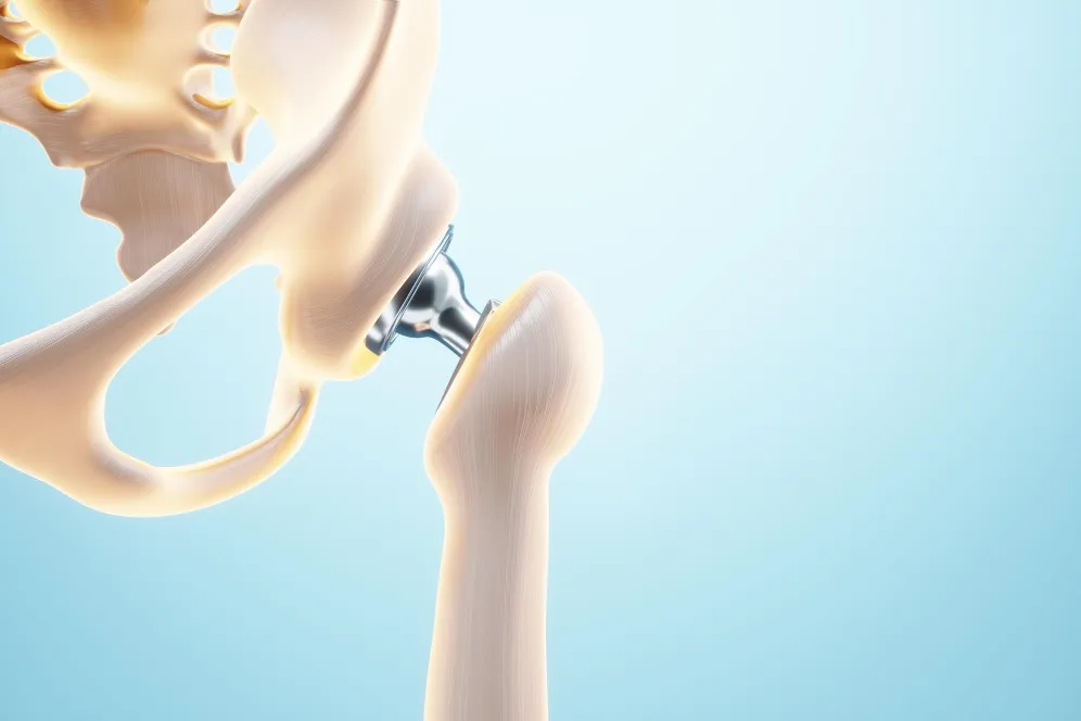 Robotic Hip Replacement in Bangalore – Advanced Su...
