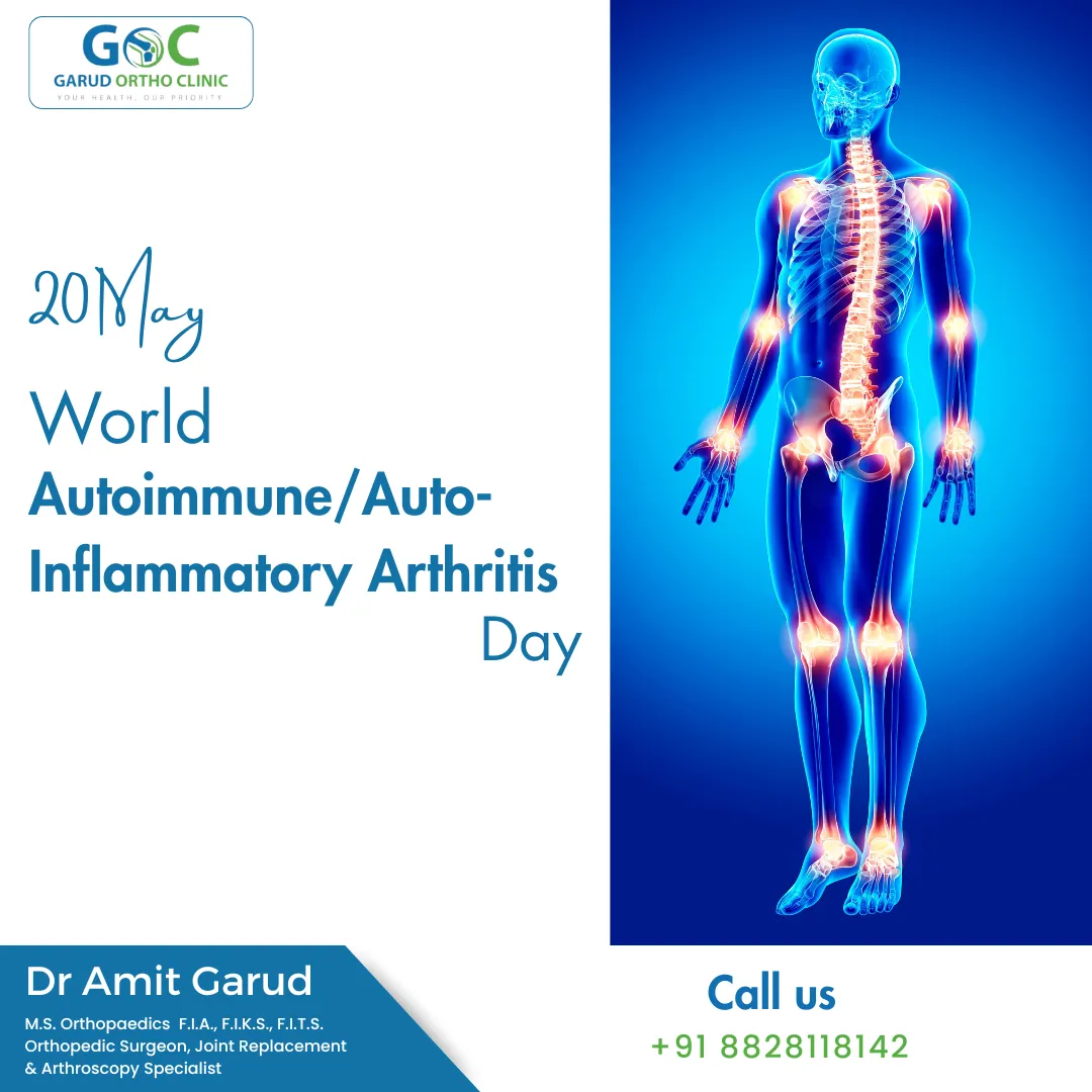 Orthopedic Surgeon, Dr Amit Garud, shares insights...
