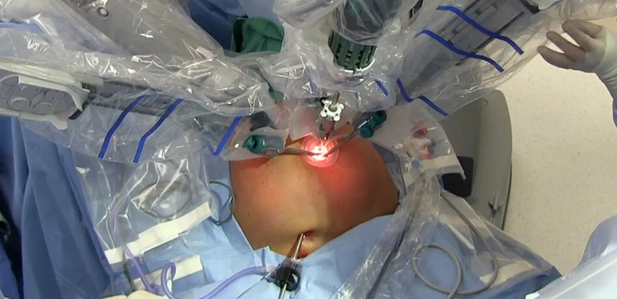 Robotic Hiatus Hernia Surgery for GERD in Dasaraha...