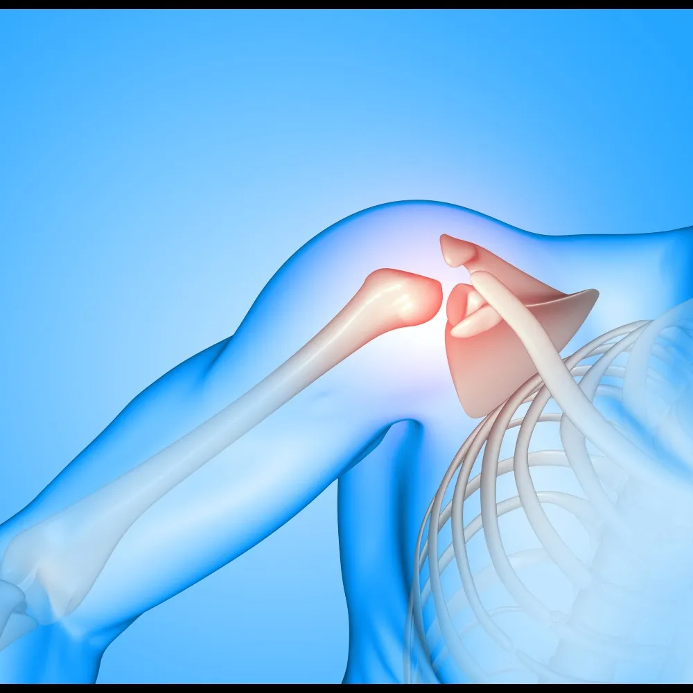 Reverse Shoulder Replacement in Bangalore – Relief...