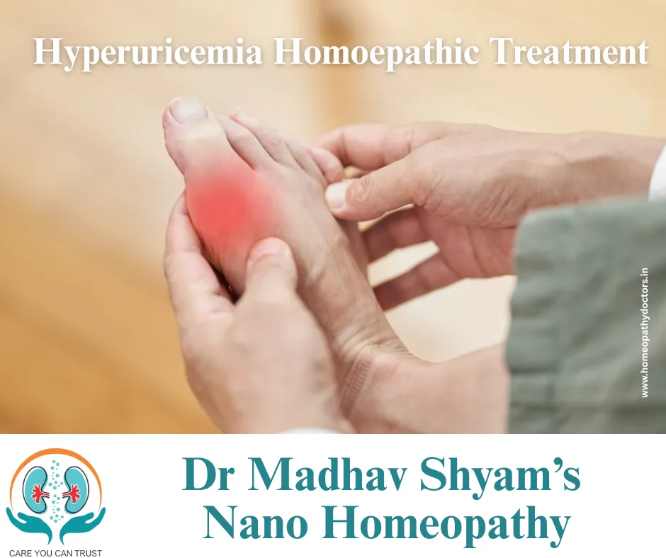 Common Homeopathic Remedies for Hyperuricemia
1. C...