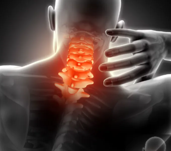 Cervical Pain – Specialised Neck Care in Noida Nec...
