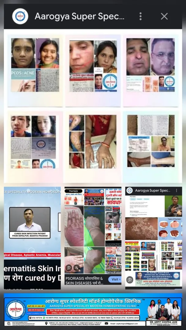 Allergic Dermatitis Skin Infection त्वचा संक्रमण र...