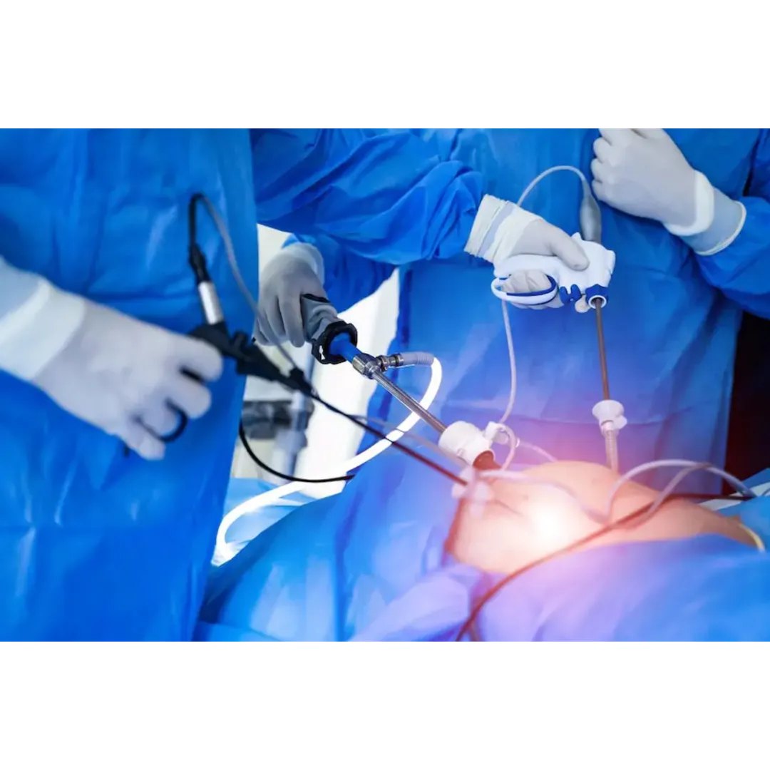 Laparoscopic Hernia Surgeon in Kolathur, Chennai f...