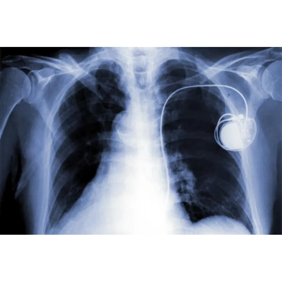 Pacemaker Surgeon in Pune for Reliable Heart Rhyth...