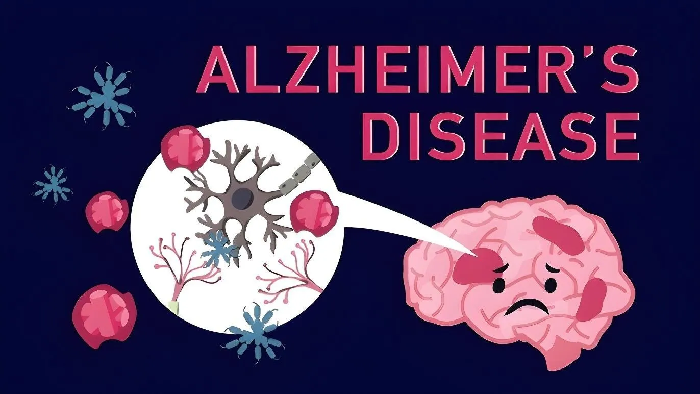 Alzheimer’s Disease And Memory Problems Treatment ...