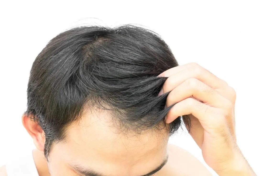 Regrow Hair Treatment in Janakpuri
Struggling wit...