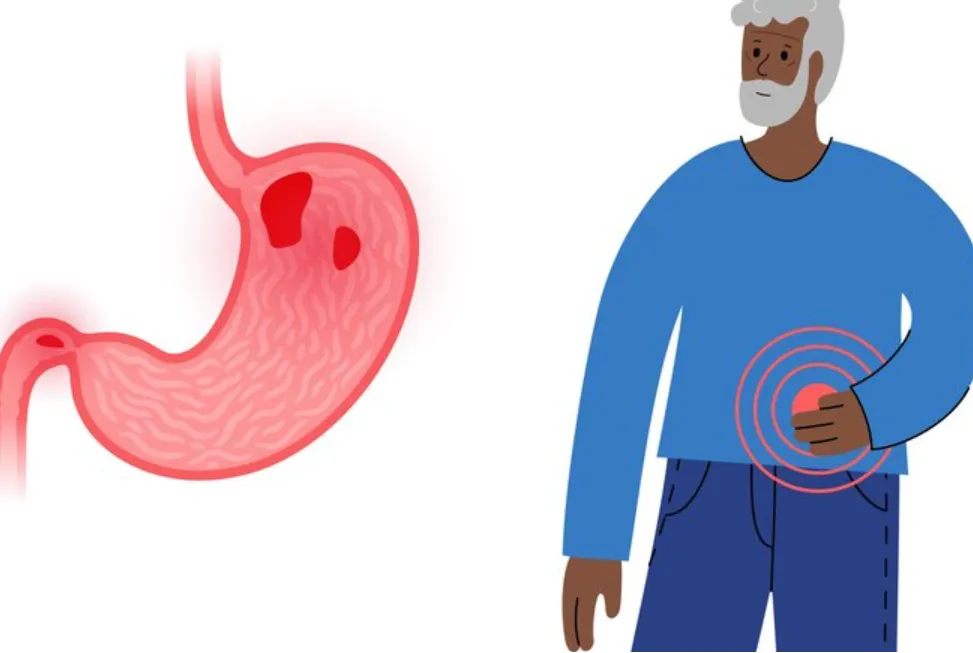 Ulcer Treatment in Kolathur, Chennai for Lasting D...