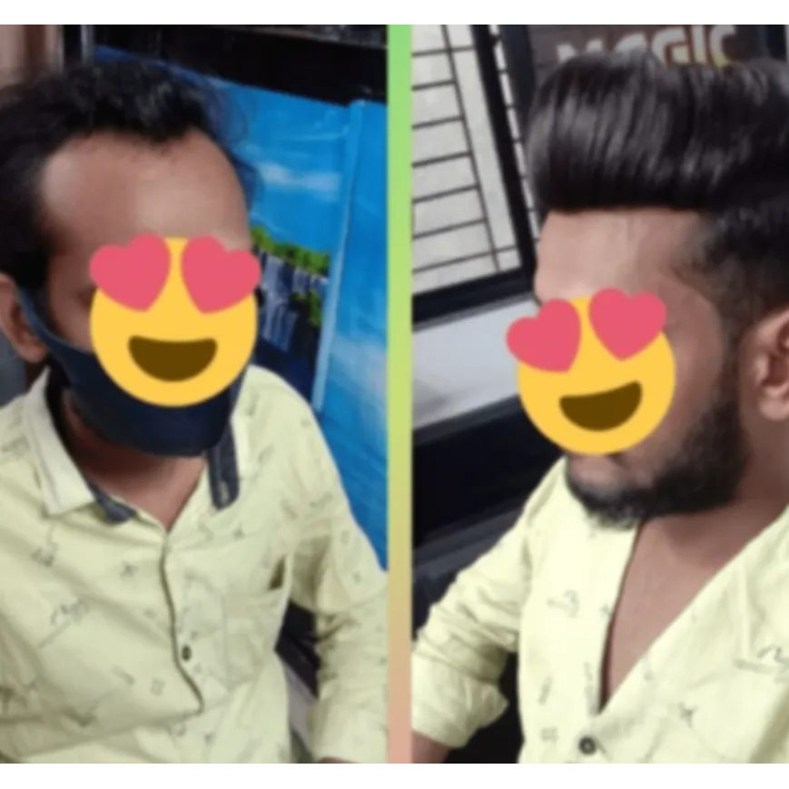 Gents Wig Center in Nagpur Catering to Modern Hair...