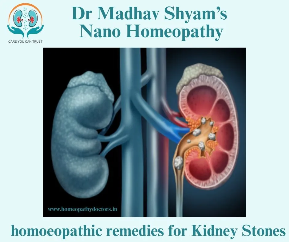 Here are the top homeopathic remedies for kidney s...