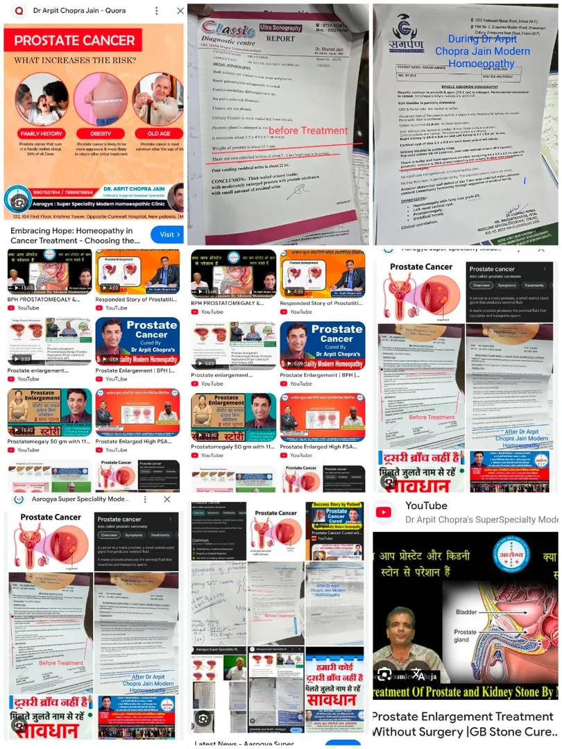 Prostate Cancer PSA more than 100, Bladder Cancer,...