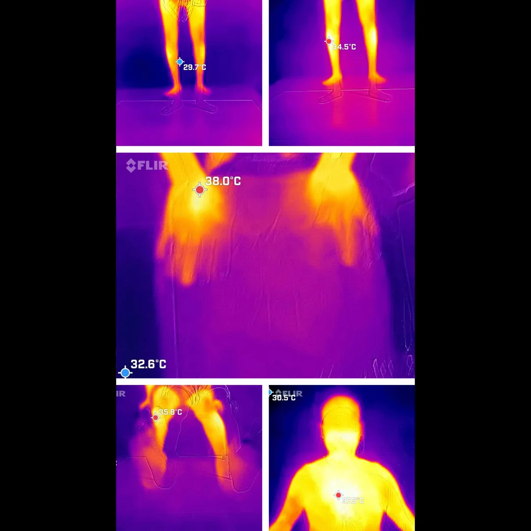 Thermography Test in Dhule – Early Detection with ...