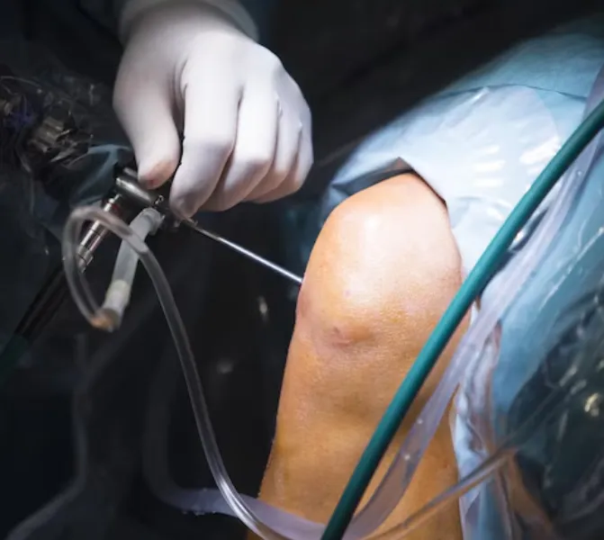 Knee Replacement Surgery in Noida: Regain Mobility...