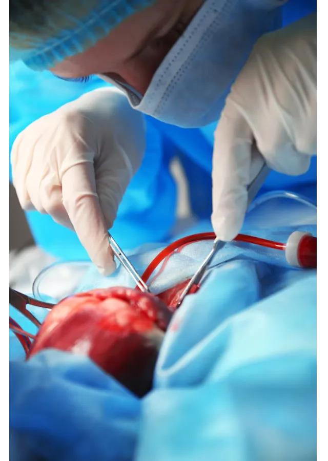 Small Incision Cardiac Surgery in Nagpur – Advance...