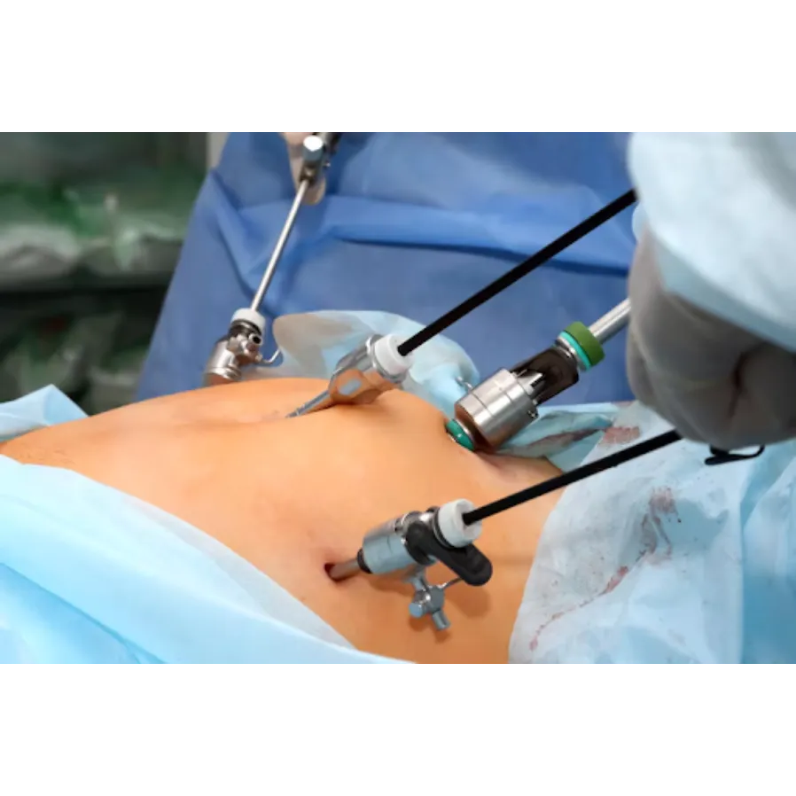 Laparoscopic Hysterectomy Procedure in Thane – Saf...